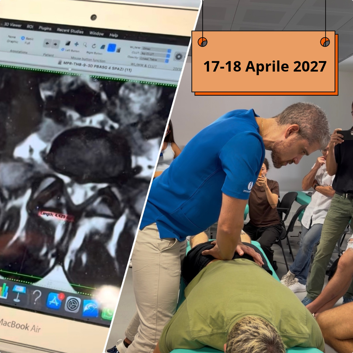 RADIOLOGY-based HVLA (Full spine adjustment e interpretazione dell'imaging strumentale)